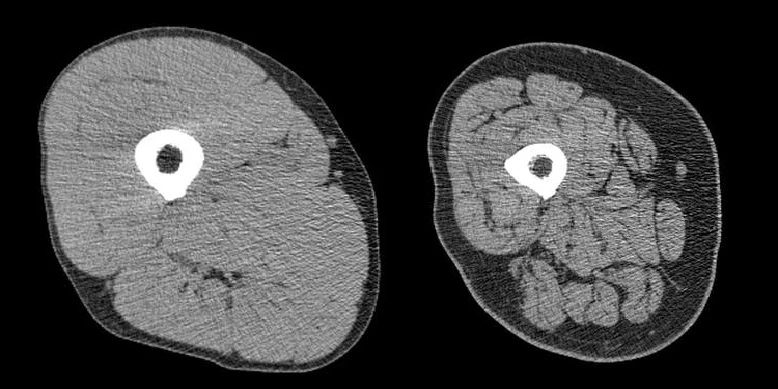 BioDatev análisis de riesgos competitivos